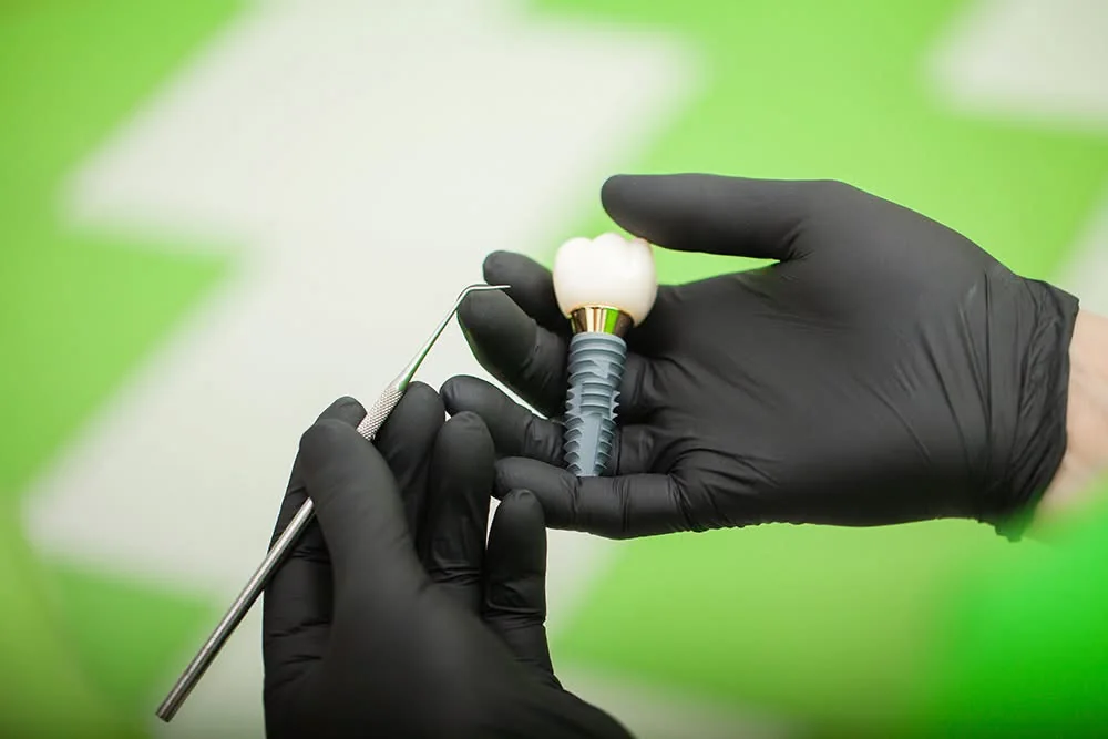 Implante dental