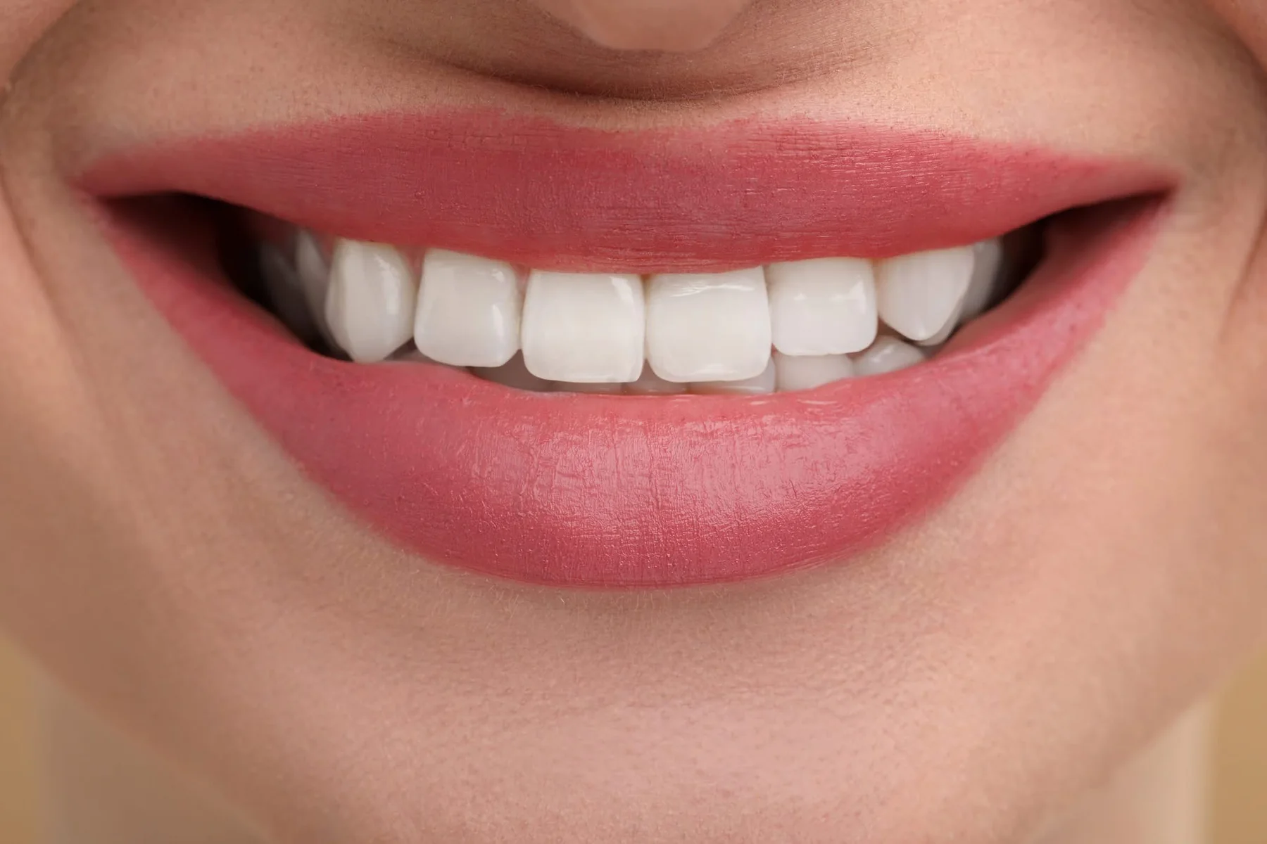 Sonrisa estética